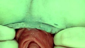 yo, check my crazy prolapso stretching wide open!