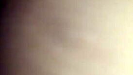 chocolate glazed in hospital setting