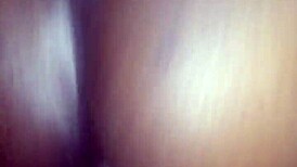 chocolate glazed in hospital setting