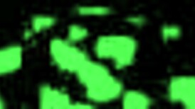 slut stacy shepard cums from hitachi therapy by doctor tampa?