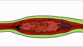 Cell Absorbs Insides Pack Amv Body Party