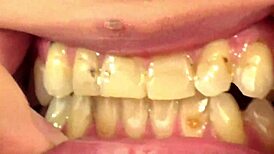 mouth vore close-up with fifi foxx devouring gummy bears