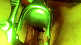 Cervix stretched wide open