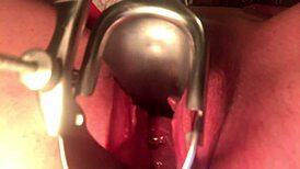 Cervix stretched wide open