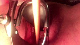 Cervix stretched wide open