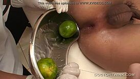 Asians Feel Kinky Medical Fetish