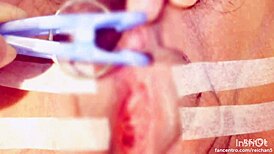 Clit sucking and pinching with an electric massage for a gay orgasm