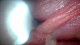 uh, i dunno how this endoscope shows penis close-ups for education...