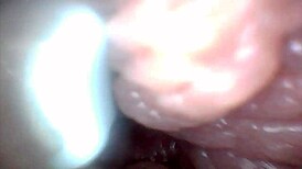 uh, i dunno how this endoscope shows penis close-ups for education...