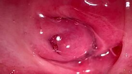 अमेच्योर पिंक पस्सी वर्जिनिटी के 172 दिन बाद फक हुई!