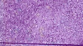 Por que a Tingting mija ao ar livre de roupa de mulher?