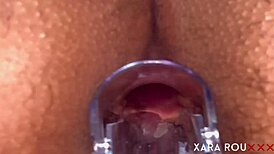 Detailed anal examination with speculum reveals tight, gaping asshole of mature BBW slut