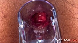 Detailed anal examination with speculum reveals tight, gaping asshole of mature BBW slut