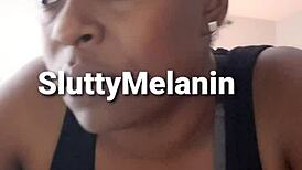 I have a penile yeast infection.