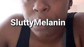 I have a penile yeast infection.