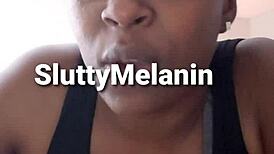 I have a penile yeast infection.