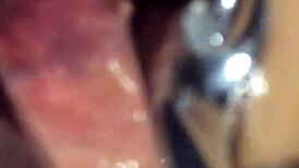 shemale uses speculum on me